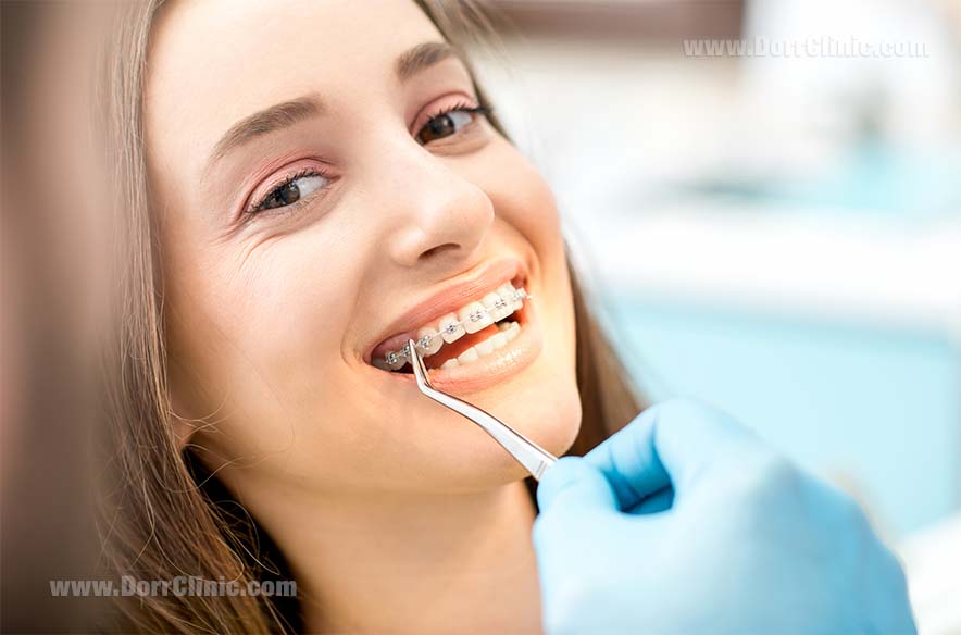 مشکلات قابل حل با ارتودنسی مشکلات قابل حل با ارتودنسی