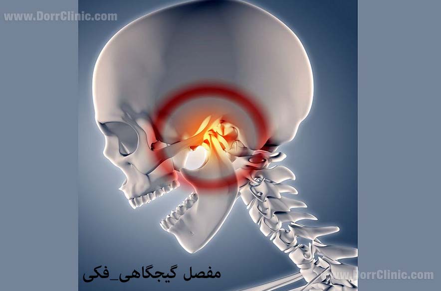 اختلالات مفصل گیجگاهی فکی