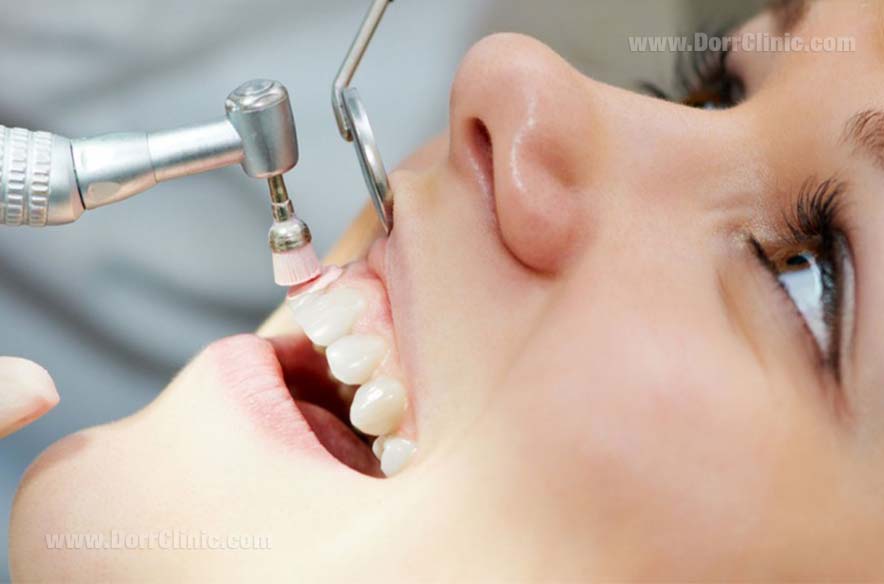 periodontitis periodontitis