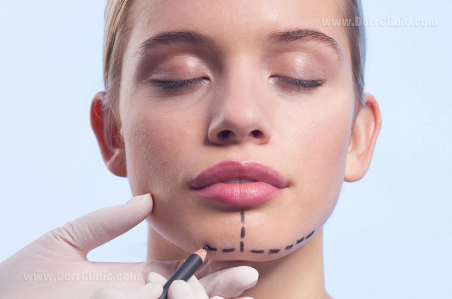 تغییرات چهره بعد از جراحی فک تغییرات چهره بعد از جراحی فک
