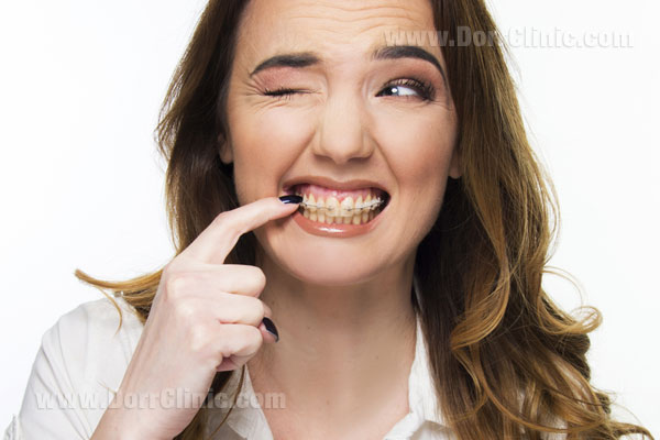 مراحل ارتودنسی