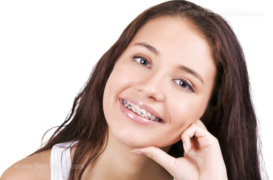 مراحل ارتودنسی