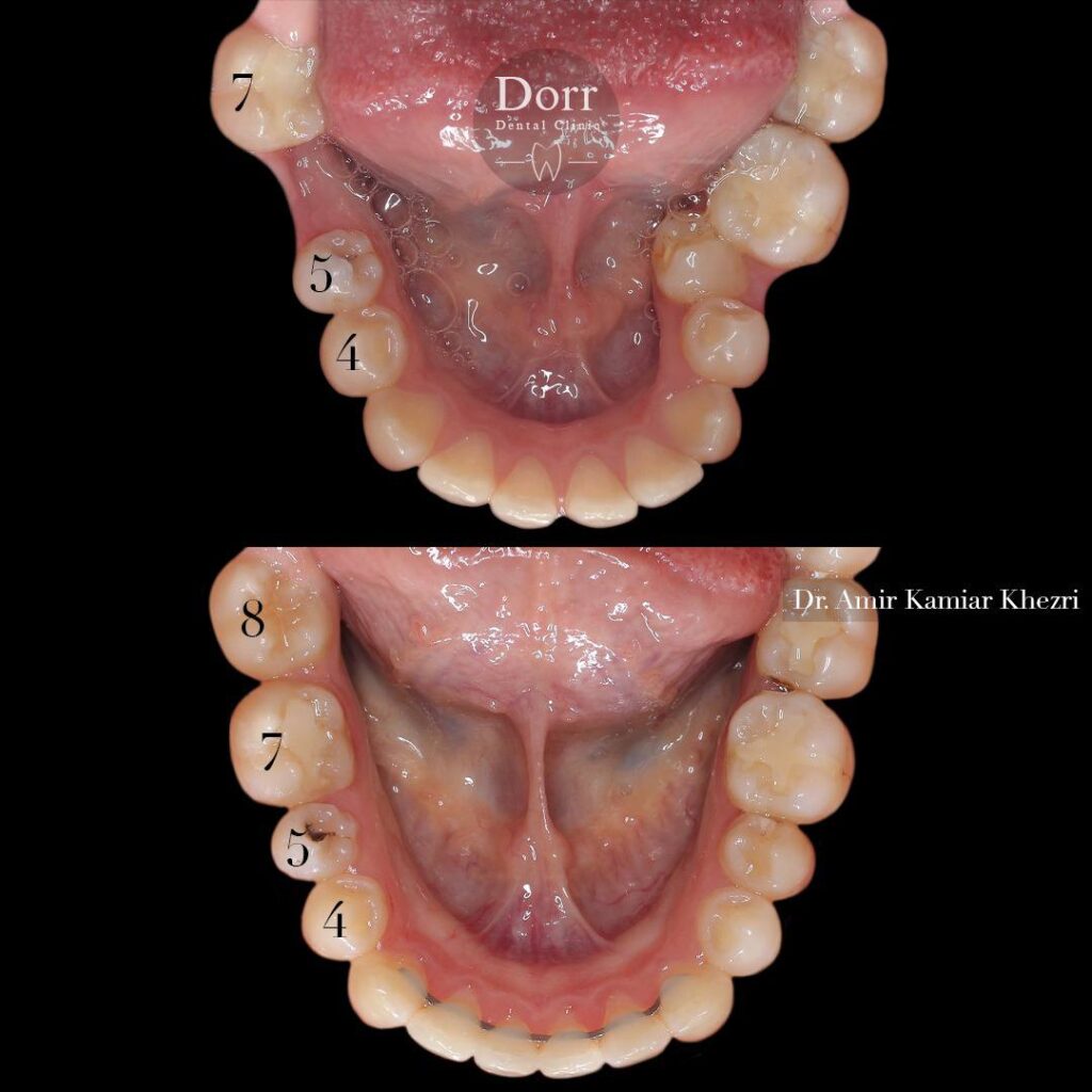 orthodontics-dr-khezri-16-4