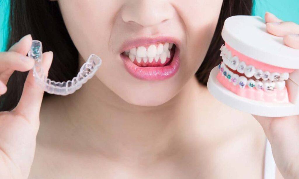 فواید ارتودنسی دندان چیست