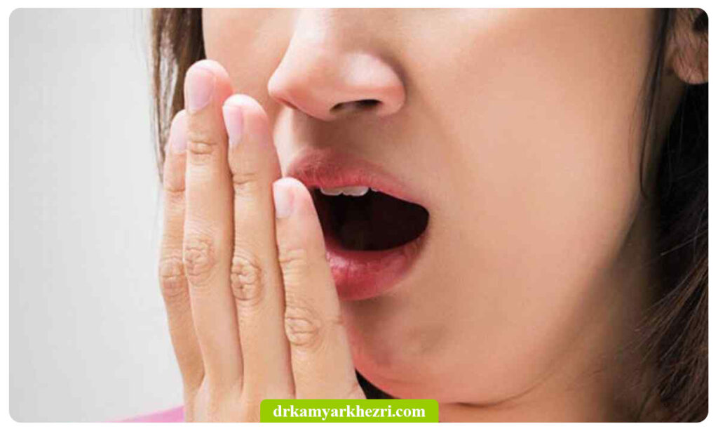 بوی بد دهان