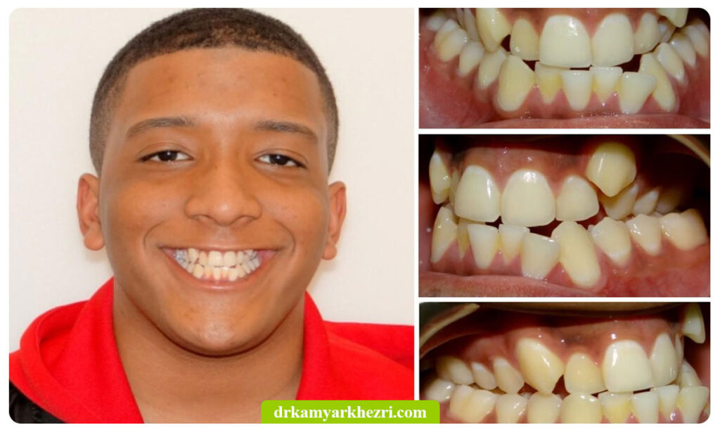 کراس بایت چیست؟