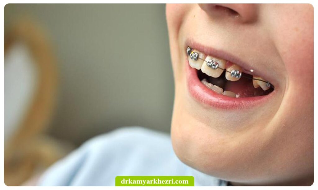 ارتودنسی ثابت