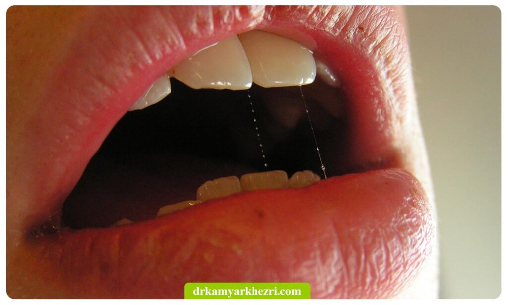 چسبندگی در دهان