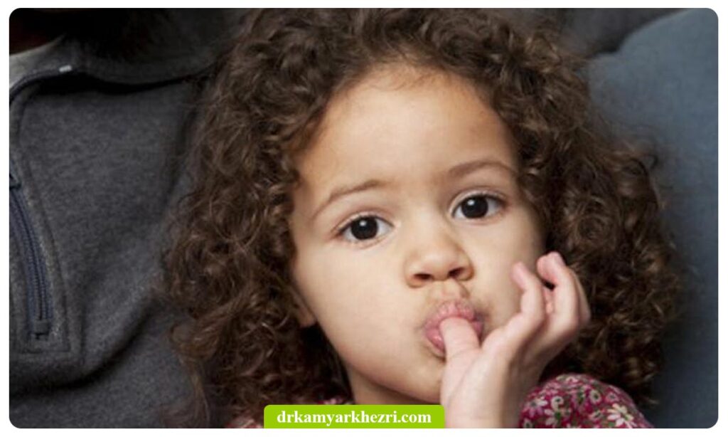 مکیدن انگشت در کودکان