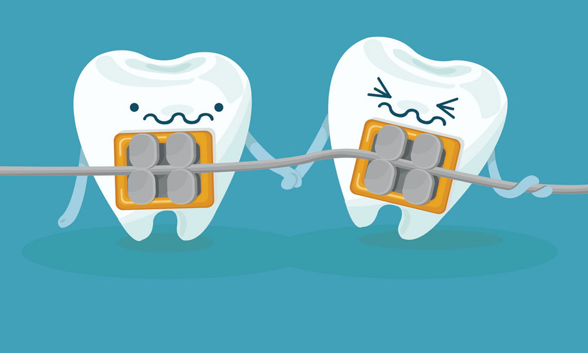 لق شدن دندان در طول ارتودنسی