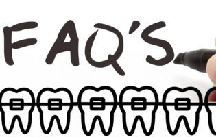 سوالات متداول ارتودنسی دندان