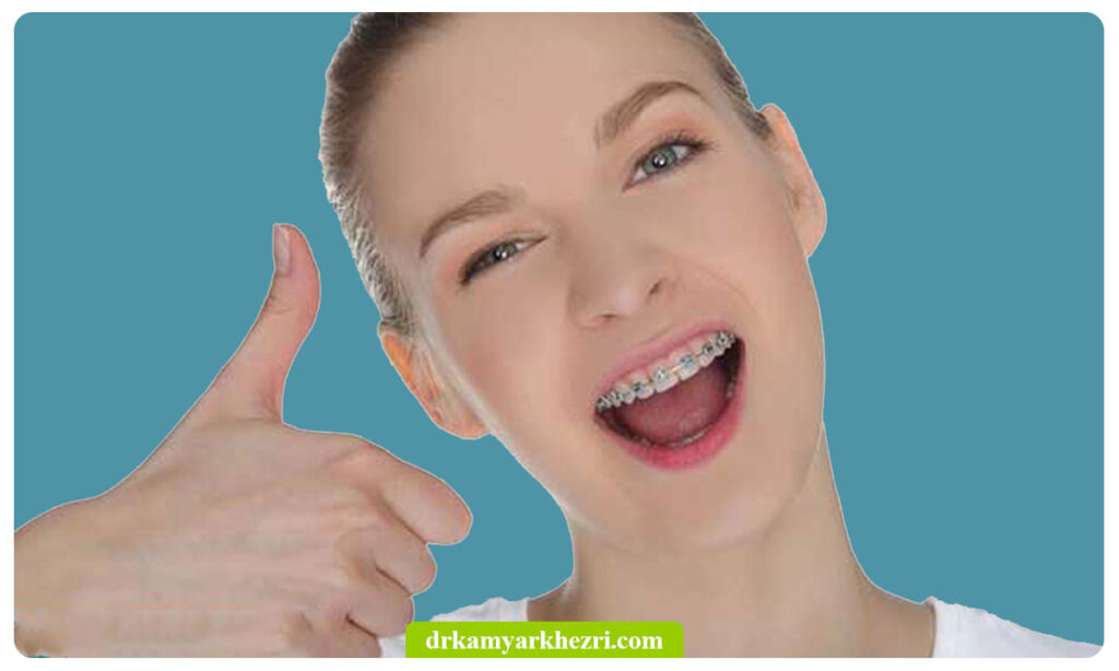 مزایای ارتودنسی دندان