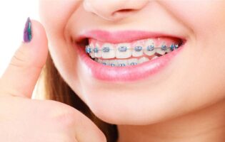 مزایا ارتودنسی برای سلامت عمومی بدن