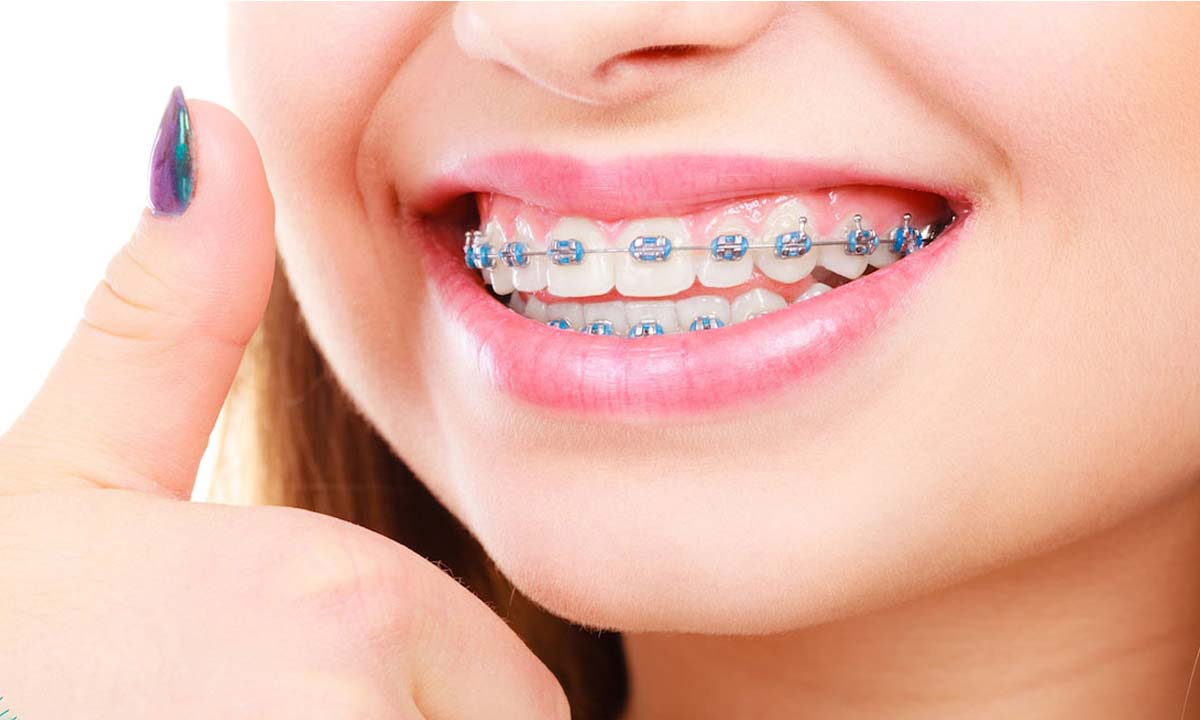 مزایا ارتودنسی برای سلامت عمومی بدن